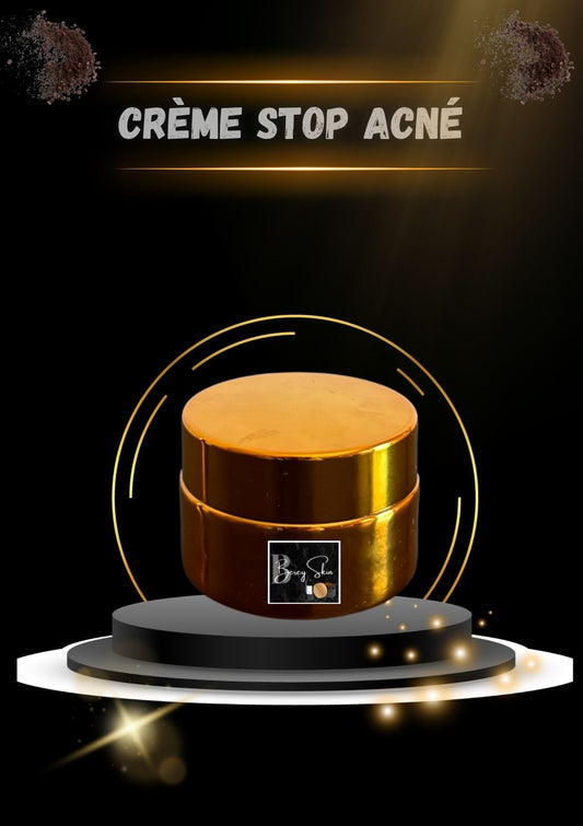 Crème Stop Acné