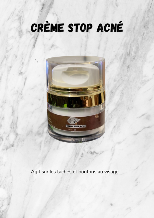 Crème Stop Acné
